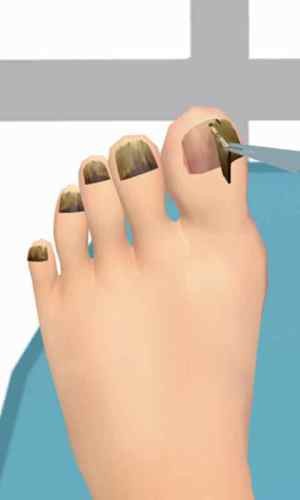 �޽�ģ����