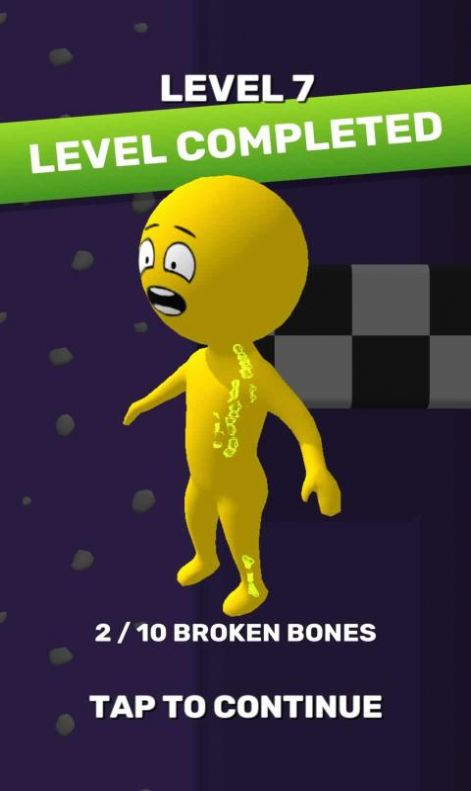 Never Broke a Bone(��δ���۹�)