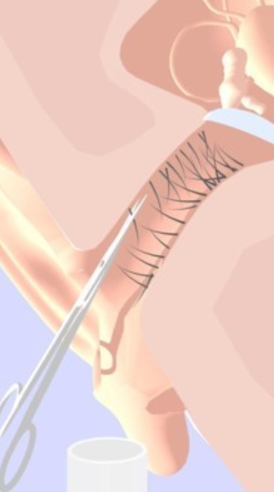 �ڶ���ģ����