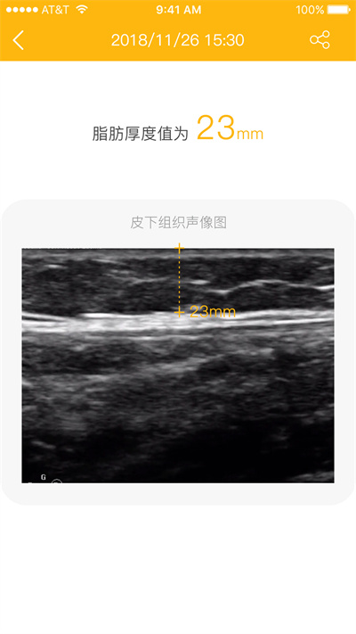 ֬�������app